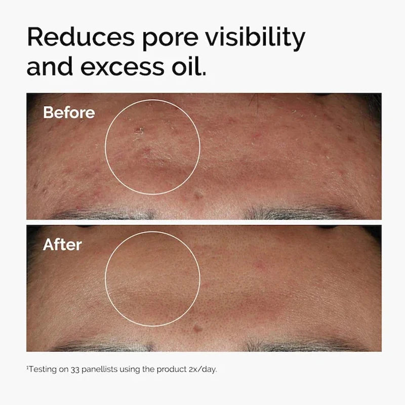 LuxeGlow Niacinamide Serum 30ml